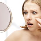 How You Get Rid of a Blemish Overnight