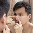 How to Get Rid of Acne on My Nose