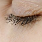 What Causes the Eyelid to Wrinkle?