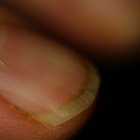 Healing a Split Fingernail