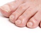 How to Stop Stinky Feet