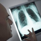 ¿Dónde ocurre la respiración?