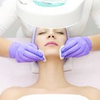 How to Get Rid of Acne & Red Cheeks and Nose