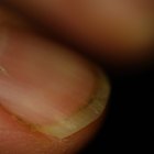 How to Get Stains From Under Your Fingertips