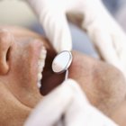 How to Clean Stains From False Teeth