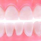 How to Soften Plaque on Teeth
