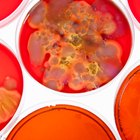 ¿En qué se parecen las bacterias y las células de los vegetales?
