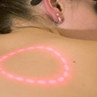 How to Prepare for Laser Bikini Hair Removal
