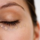 How to Strengthen Blood Vessels to Combat Dark Circles