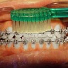 How to Increase Circulation to the Gums