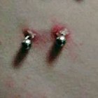 How to Remove a Captive Navel Ring