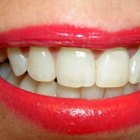 Do it Yourself Teeth Whitening