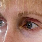How to Remove Wrinkles Around the Eyes