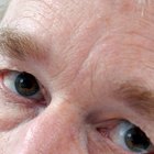 The Best Eye Serums to Remove Puffiness