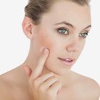 The Best Organic Skin-Care Lines for Acne