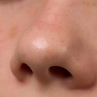 Cómo eliminar los puntos negros de la nariz