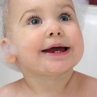 Cómo tratar el cuero cabelludo seco en el bebé