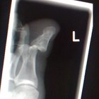 What to expect at rheumatology appointment