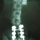 Como dimensionar um colar cervical