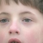 Cómo deshacerte de las bolsas bajo los ojos de tu hijo