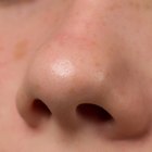 O que é um esporão ósseo nasal?
