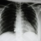 Difference between radiography & radiology