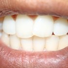 Como cuidar de cortes dentro da boca perto dos dentes