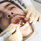 Trabajos internacionales para higienistas dentales