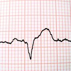 Como o sistema cardiovascular ajuda a manter a homeostase