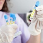 Resultados enzimáticos normais de exames de sangue