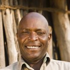 Tratamientos para la alopecia de barba