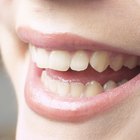 Los mejores métodos para eliminar las manchas de nicotina en los dientes