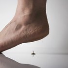 Quais são as curas para a síndrome do pé caído?