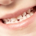 ¿Las tabletas para la dentición ayudan a los niños que muerden?