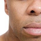 Qual é a causa do nariz bulboso?