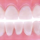¿Qué es lo que sostiene mejor mis dientes postizos?