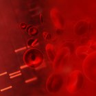 Altos níveis de dióxido de carbono no sangue