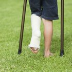 Por que o pé fica inchado após a fratura da perna?