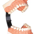Abreviaturas de terminología dental