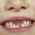 ¿A qué edad los niños dejan de creer en el hada de los dientes?