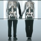 Osteoporosis en adolescentes