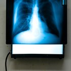 ¿Cuánto ganan los técnicos de rayos X y los de ultrasonido?