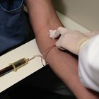 Que tipo de exame de sangue é feito no caso de cirrose hepática?