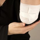 elbow pain after culrs