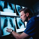 As desvantagens de ser um técnico em radiologia