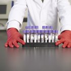 Como medir e calcular o clearance de creatinina