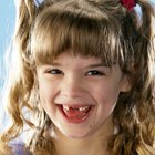Desarrollo tardío de los dientes permanentes