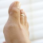 La historia del anillo del dedo del pie