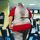Como eliminar o odor corporal em pessoas com sobrepeso