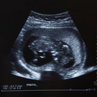 Mid section view of a pregnant woman